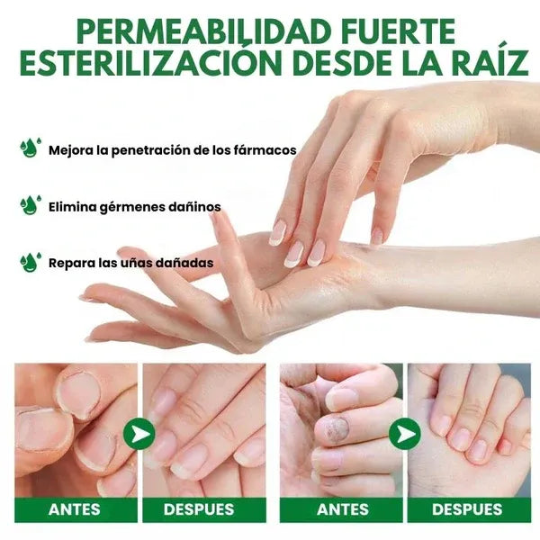 ANTIHONGOS X 2 UNIDADES